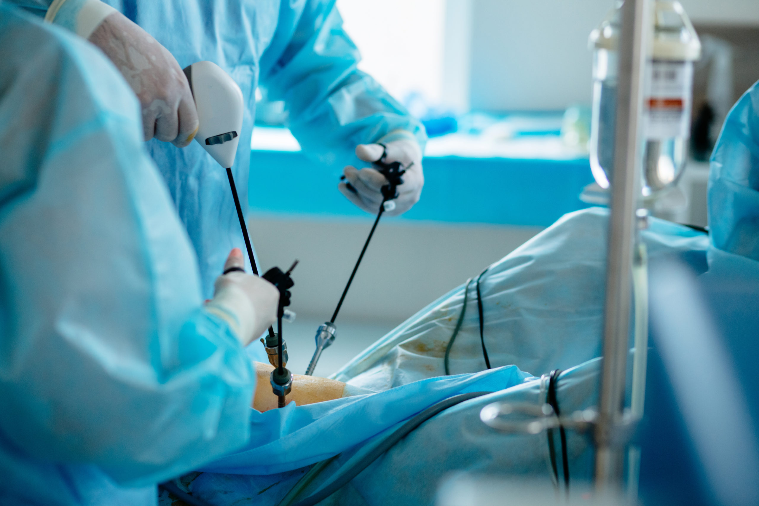 China’s surgical advanced energy devices market outlook: wider VBP rollout and intensifying competition